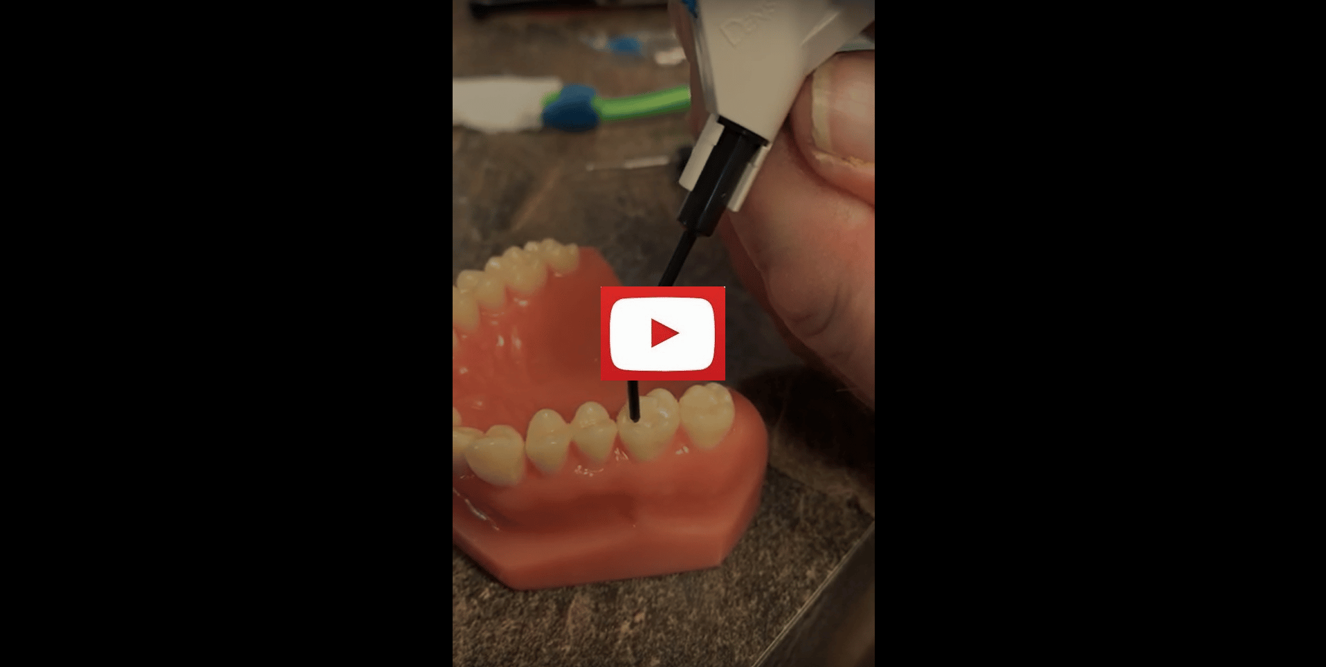 Learn how sealants are applied on your teeth!